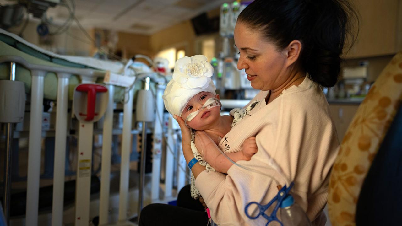 Liliya Bachinskiy holds baby Micaela, three days after the 9-month-old was successfully separated from her conjoined twin, Abigail, at UC Davis Children’s Hospital.